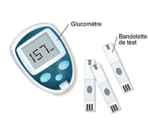 Un glucomètre et des bandelettes de test.